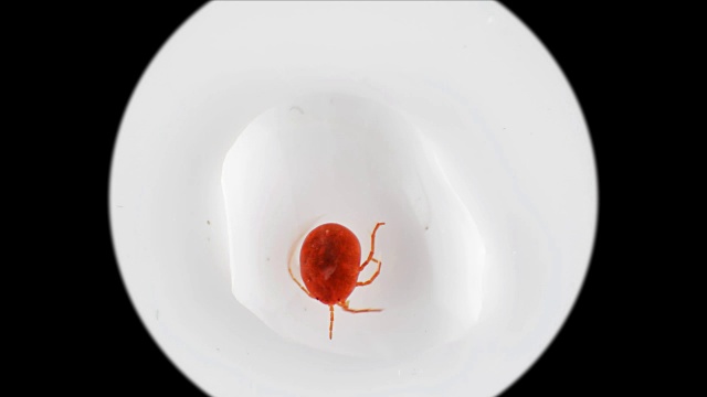 显微镜下的水螨水螅虫视频素材