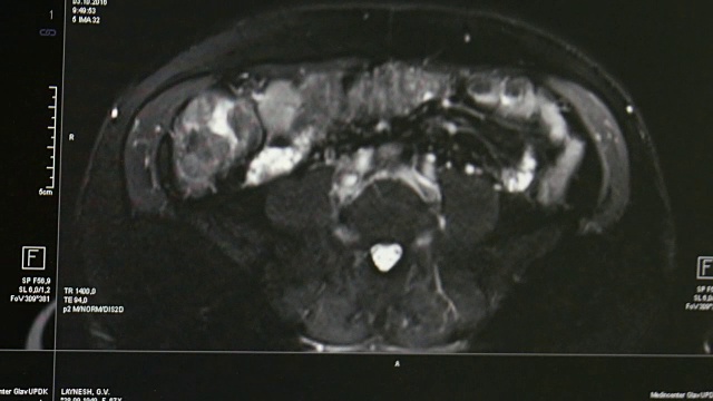 专业医疗设备MRI扫描的脑部断层扫描。视频素材