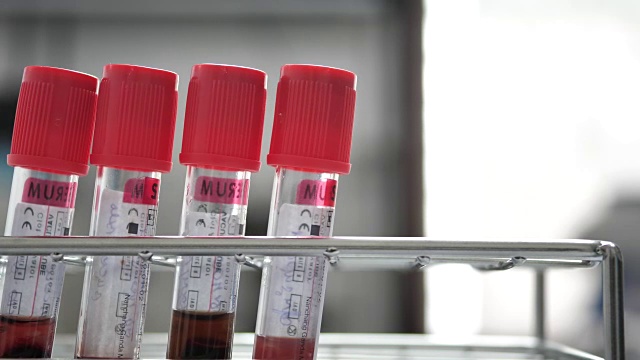 科学家在实验室验血视频下载
