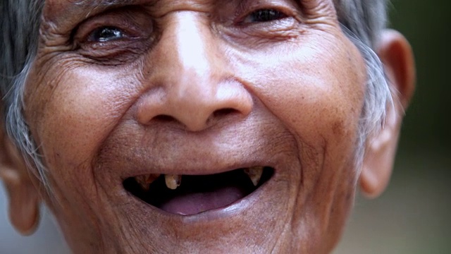 肖像快乐年长的亚洲人与牙齿问题笑着看着相机。视频下载