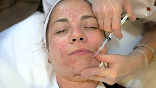 美容注射，年轻女孩在美容师的程序，医生手在手套做脸部衰老注射在女性面部皮肤，近距离。美容、水疗或美容院视频素材
