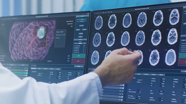 在实验室的个人电脑上展示和指向CT/ MRI大脑扫描图像的科学家的手的特写。医学研究中心的神经学家/神经科学家致力于脑肿瘤的治疗。视频素材