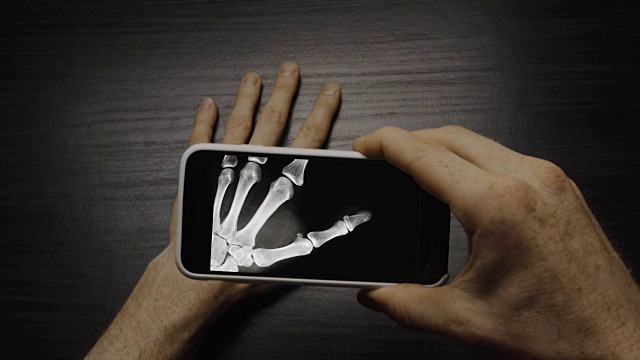 用智能手机4K扫描手骨结构的x光应用程序视频下载