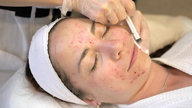 美容注射，年轻女孩在美容师的程序，医生手在手套做脸部衰老注射在女性面部皮肤，近距离。美容、水疗或美容院视频素材