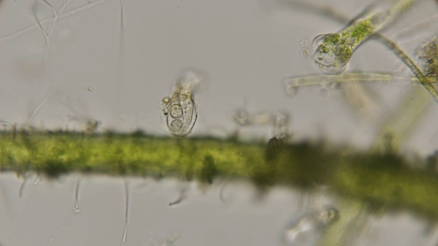 在显微镜下观察了染红halteria的水槽中的滴虫种peritricha视频素材 Id Vcg42n Vcg Com